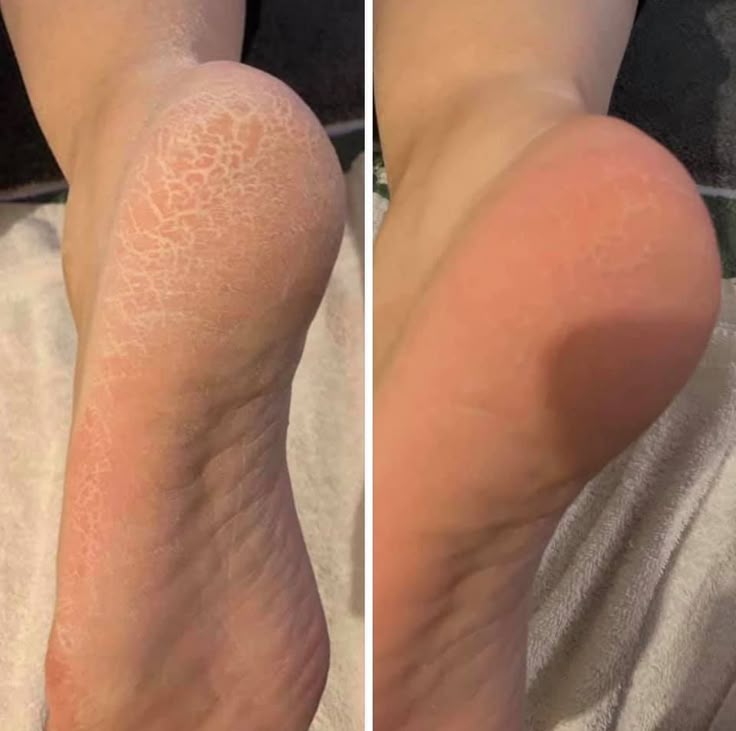 Nano-Glass Foot Filer