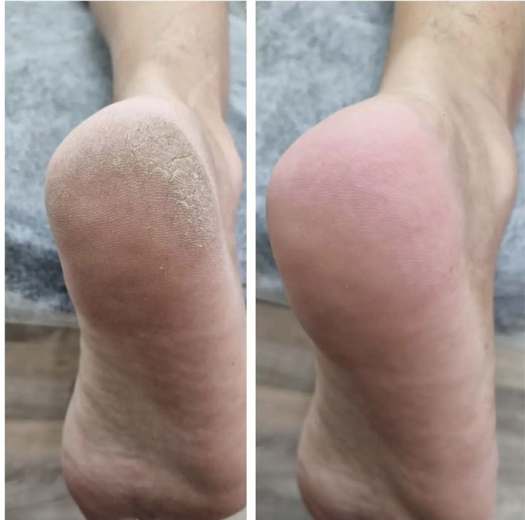 Nano-Glass Foot Filer