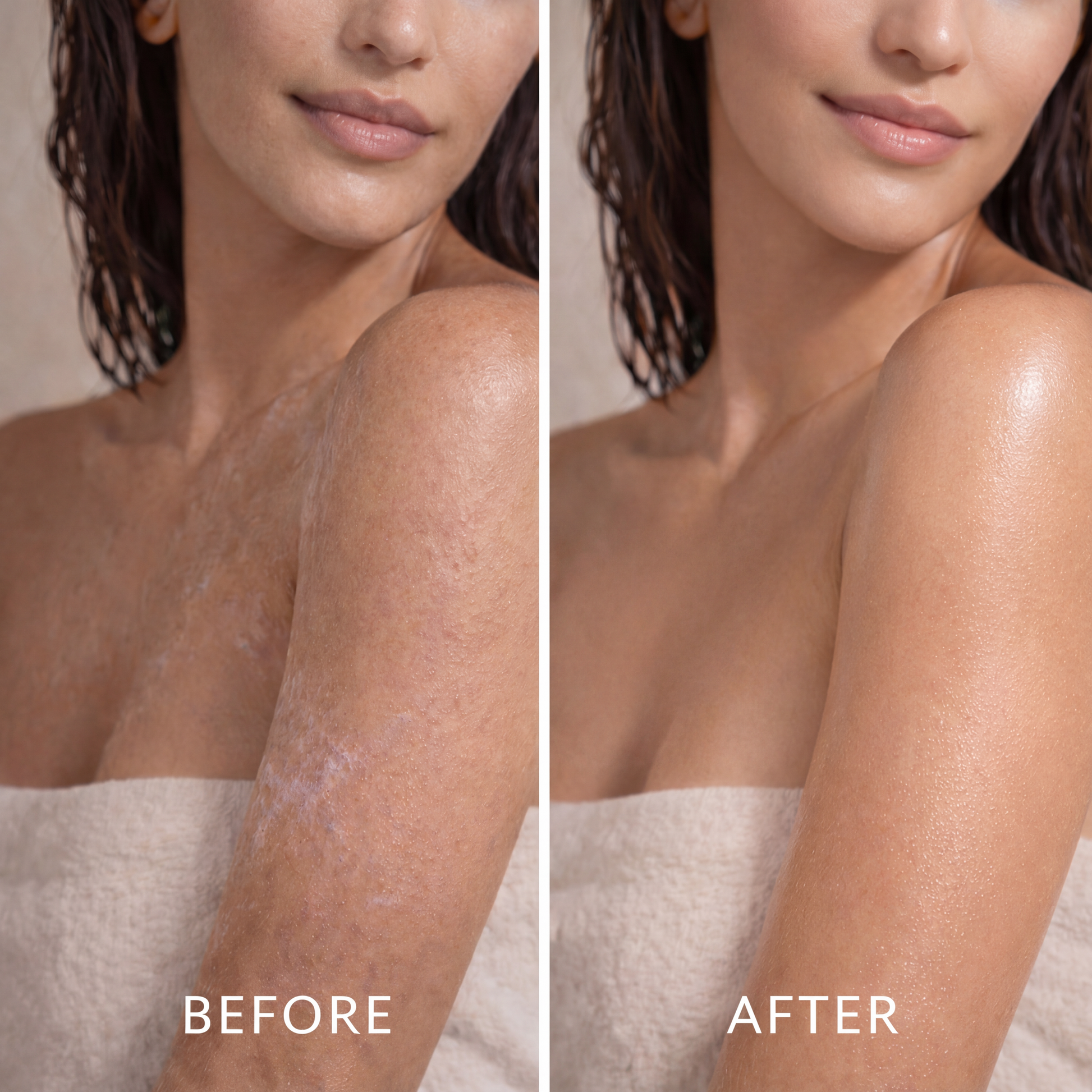 Before and after comparison of a woman's shoulder, showing improved smooth, radiant skin after skincare treatment.