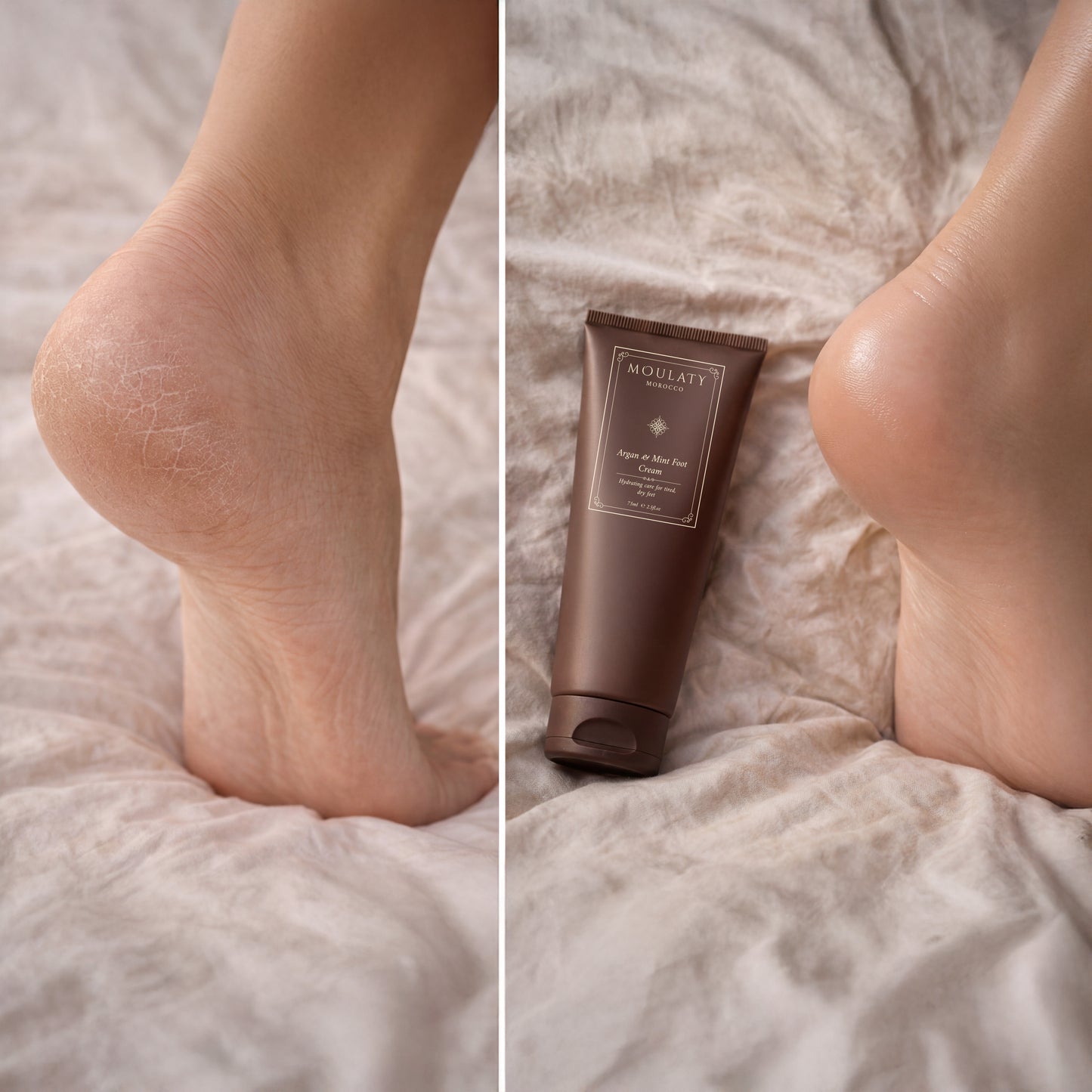 Foot cream before and after, showing dry cracked heel and smooth hydrated heel with cream tube